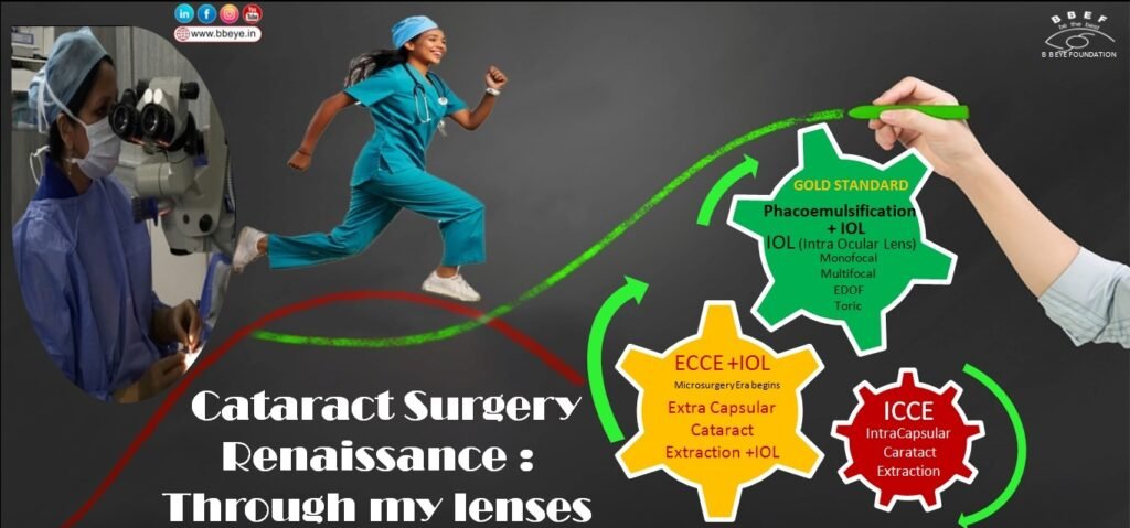 Cataract Surgery Renaissance: Through my lenses